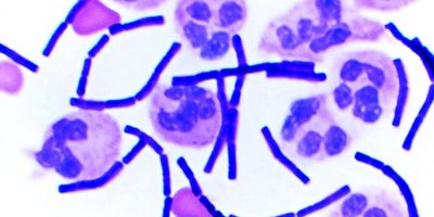 Şarbon Bacillus Anthracis